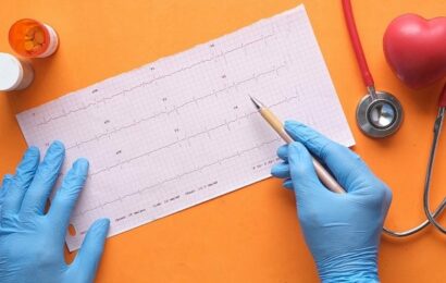 Klasifikace Elektrokardiogramu (EKG) – díl první