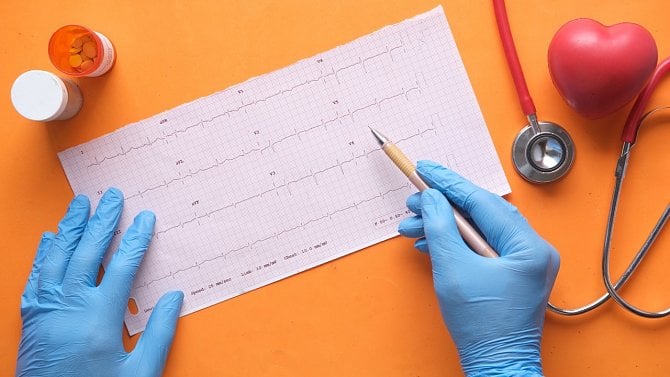 Klasifikace Elektrokardiogramu (EKG) – díl druhý